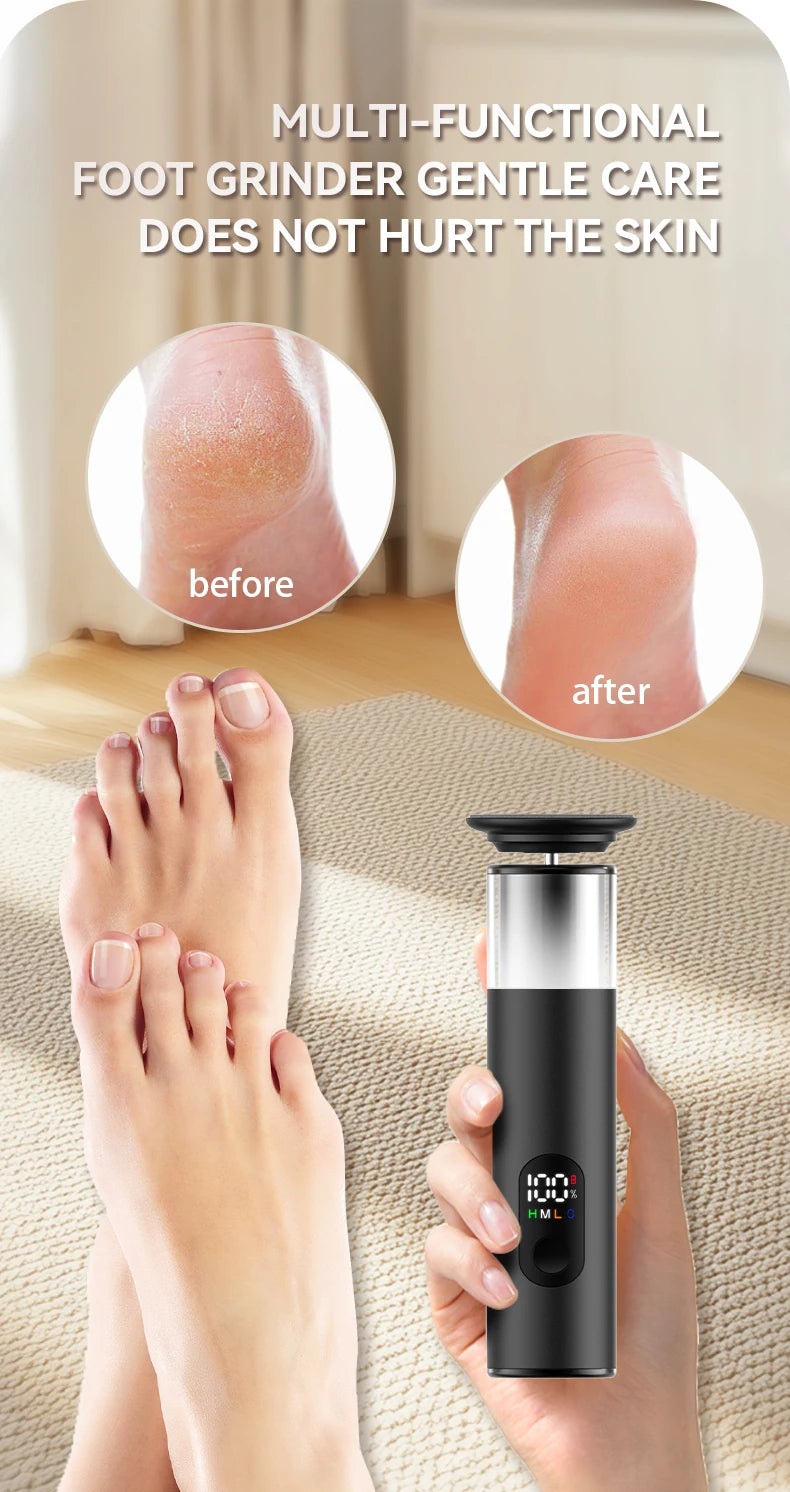 Rechargeable Electric Foot Callus Remover, 9-Level Pedicure Grinder